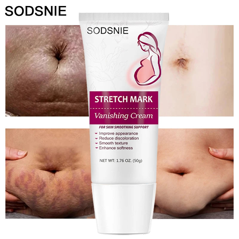 Stretch Mark Repair Cream
