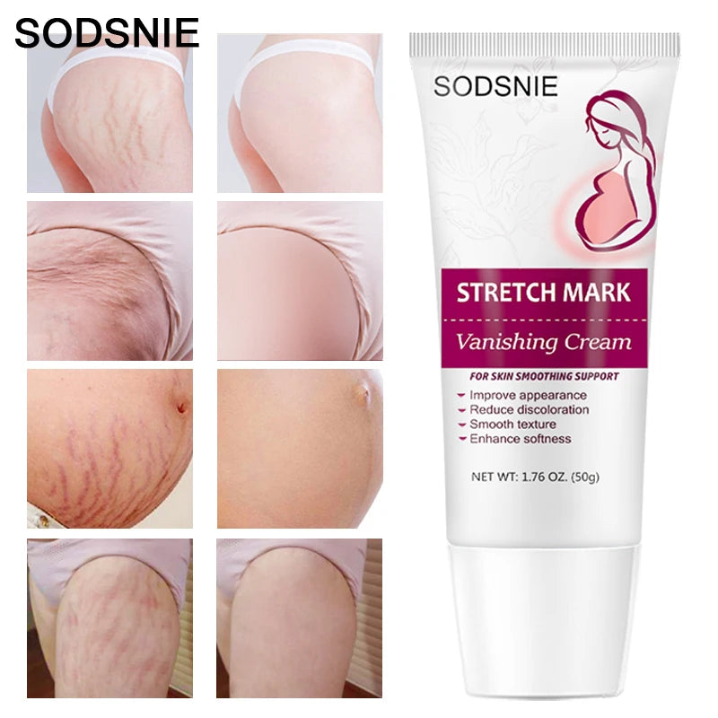 Stretch Mark Repair Cream