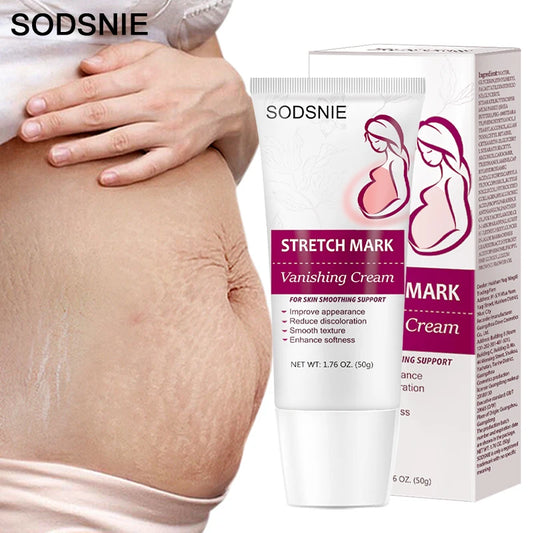 Stretch Mark Repair Cream